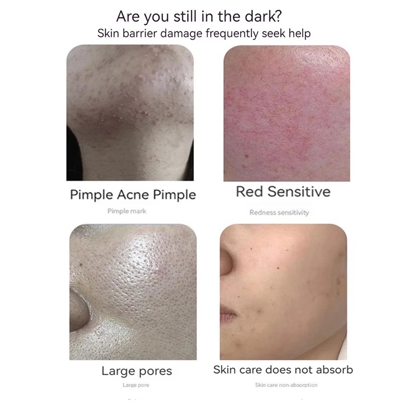 GHK-Cu 블루 코퍼 펩타이드 동결건조 파우더 세트  - Oligopeptide Wrinkle 리뷰 및 가격
